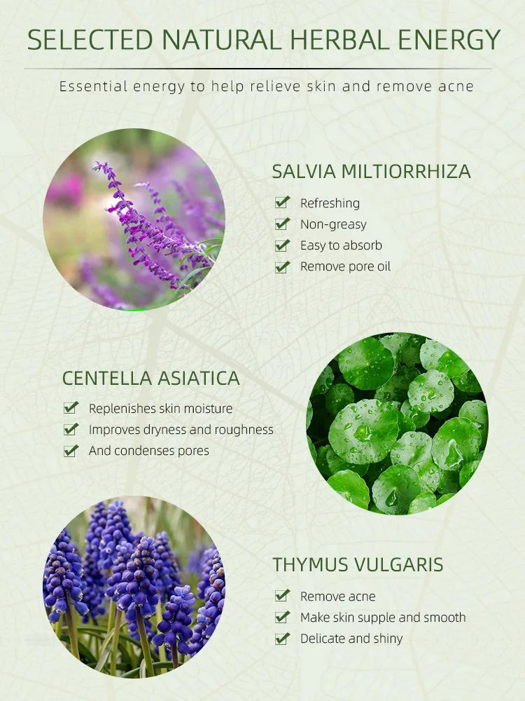 AcneErase Herbal Treatment Cream — Reduce Breakouts, Fade Marks, Moisturize All Day