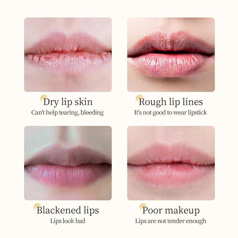 HydraHoney Vitamin E Lip Treatment — Anti-Crack, Long-Lasting Lip Nourishment