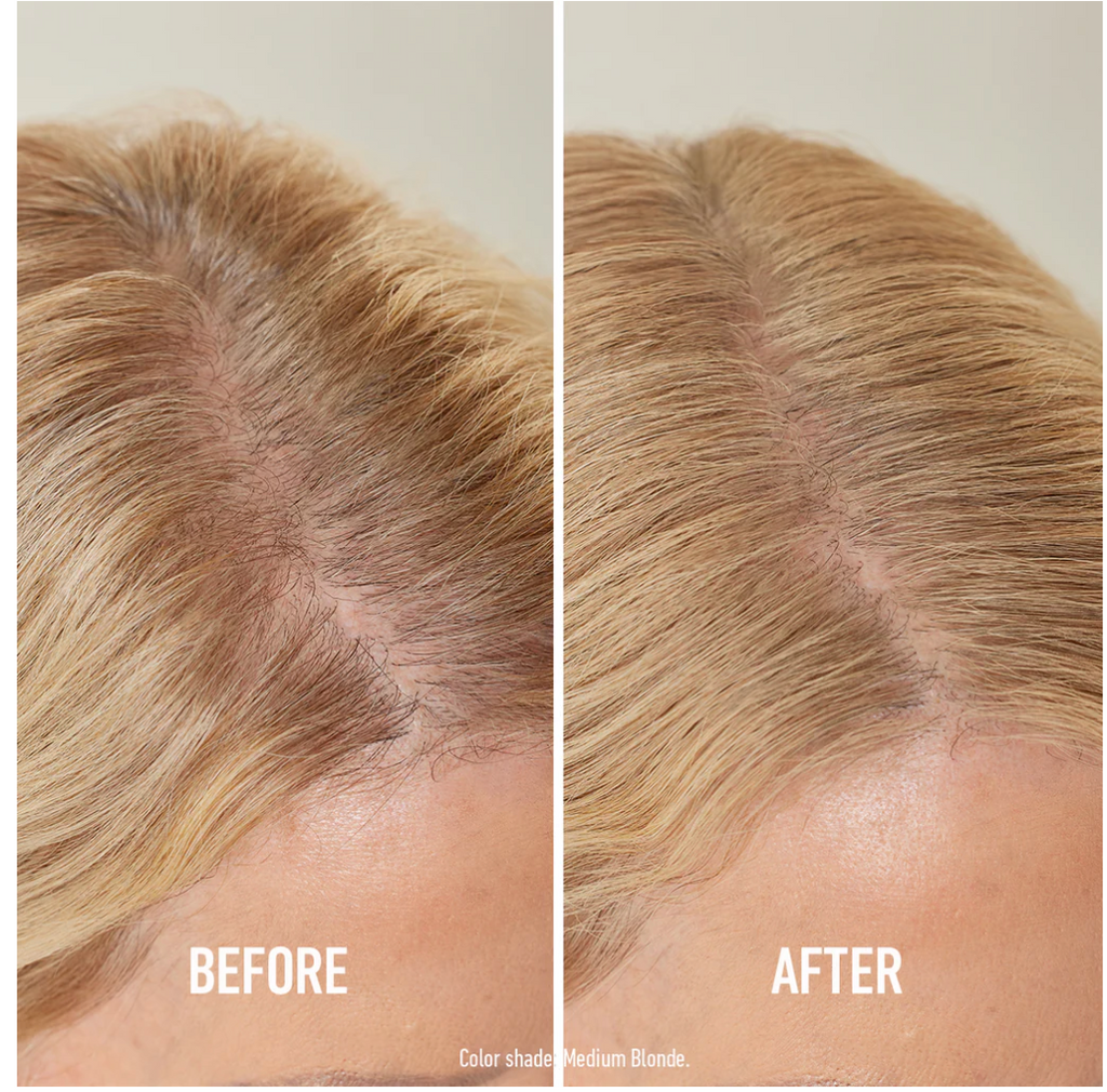 Instant Hairline Powder™ – Bald Spot & Thinning Hair Coverer